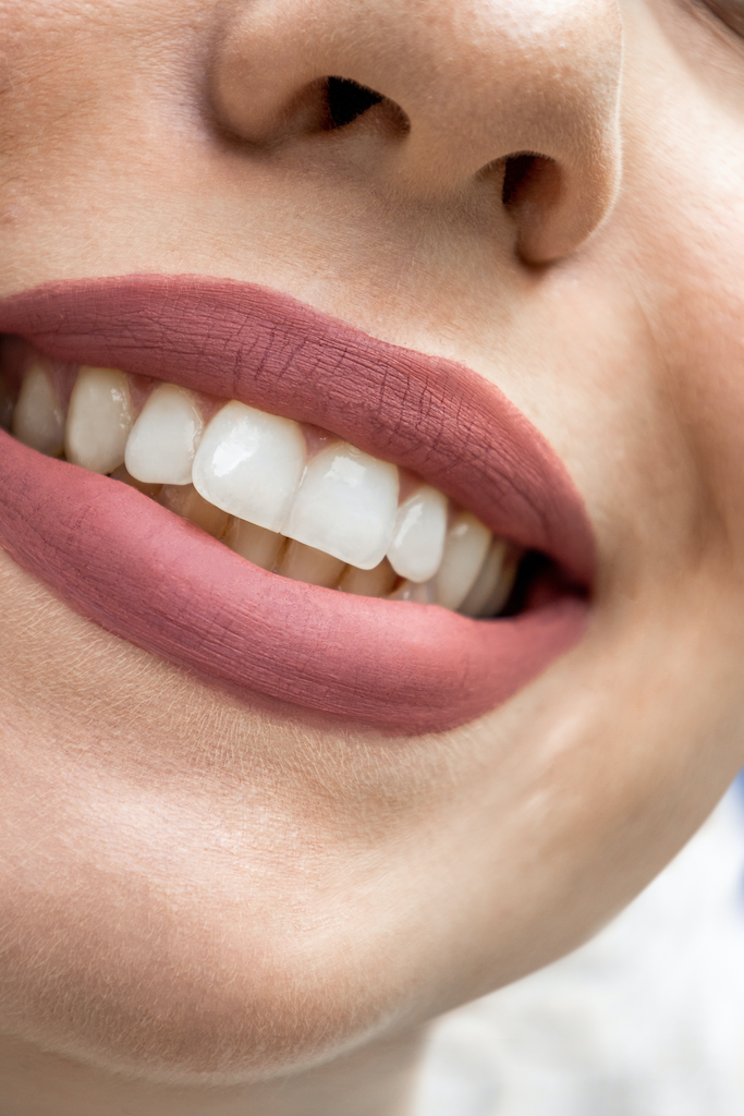 Celebrity Teeth Whitening Secrets